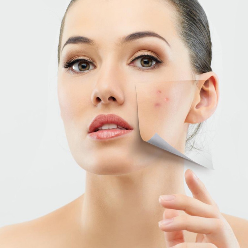 Remoção de manchas a laser - Dermatologista Curitiba
