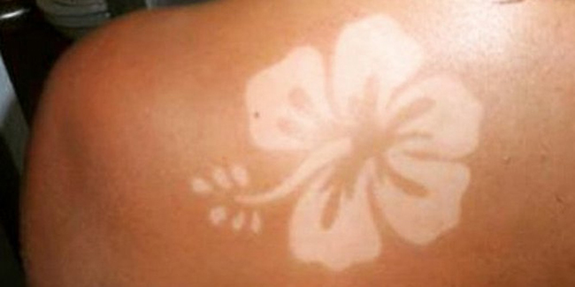 Sunburn Art: tendência perigosa para a pele - Dermatologista Curitiba - Clínica CMP